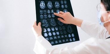 Radiologia cranio